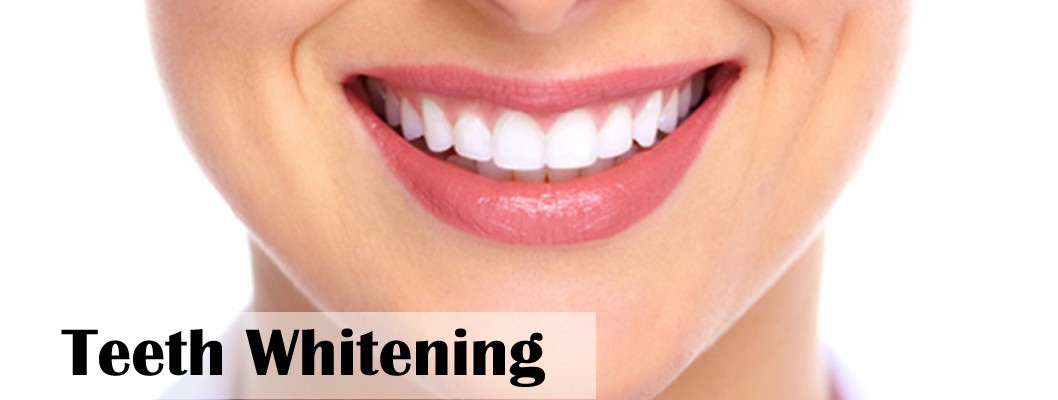 Teeth Whitening